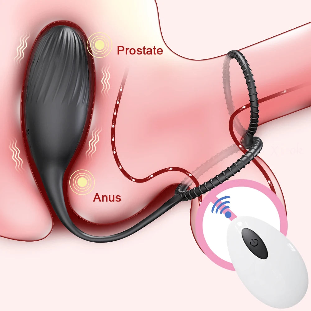 Remote-Control Prostate Massager with Ring