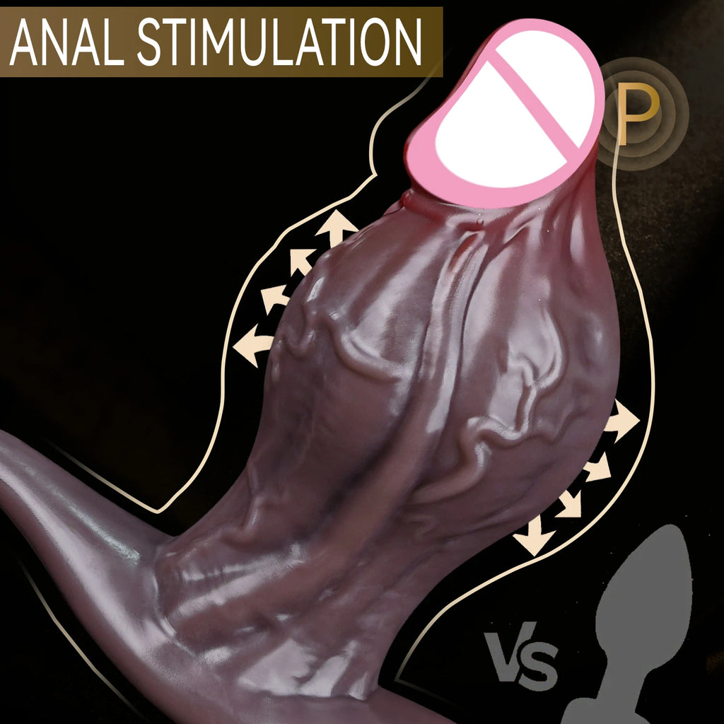 Remote-Control 10-Mode Prostate Massager