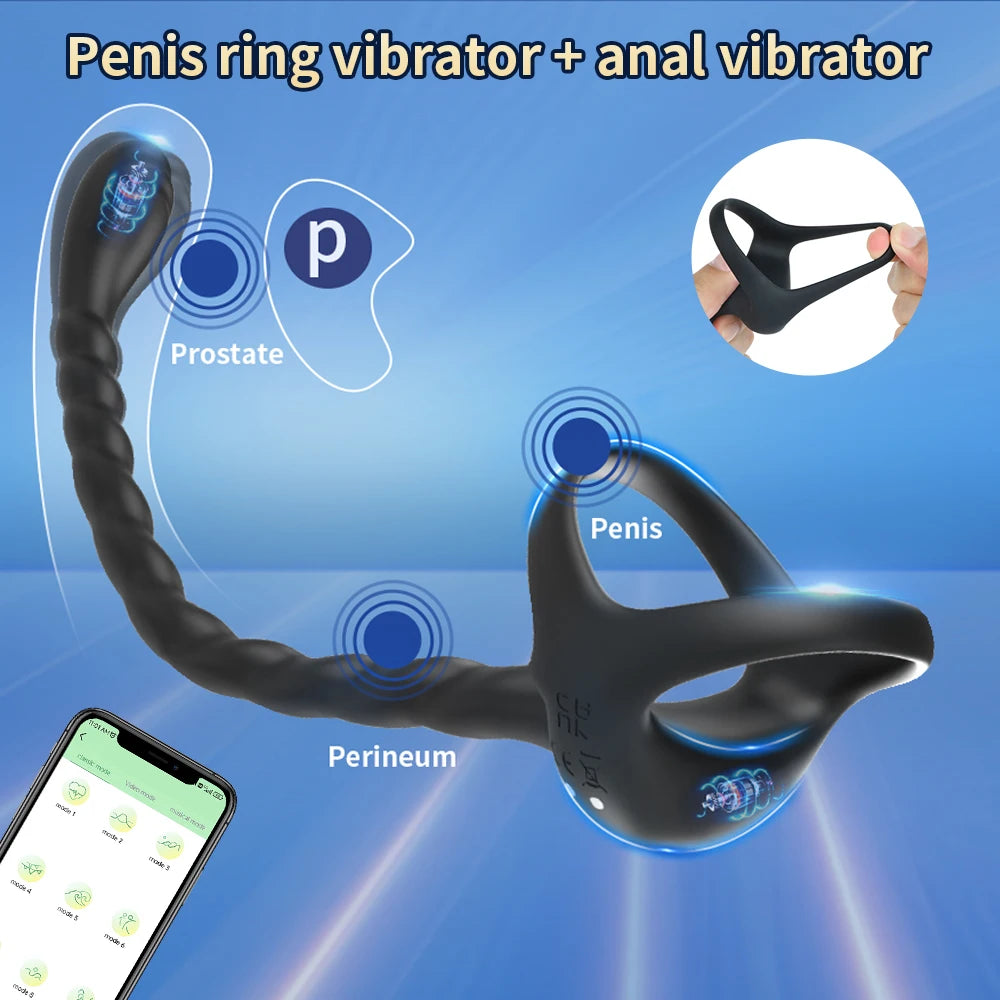 Remote-Control Prostate Massager with Ring