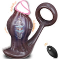 Remote-Control 10-Mode Prostate Massager