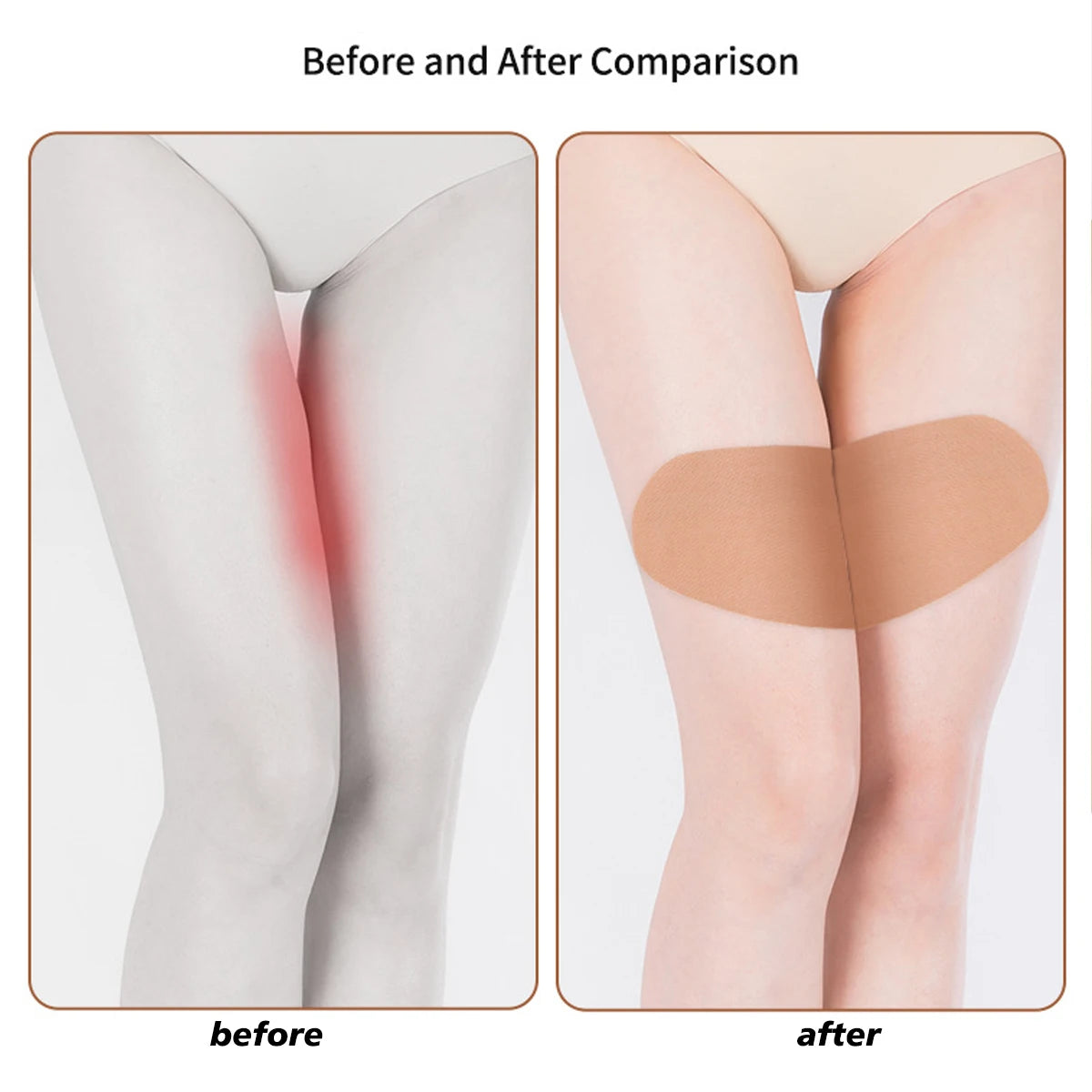 2 PCS/4 PCS Thigh Lift Tape,Thigh Inner Prevention Friction Patch, Anti Chafe Thigh Skin Tape, Chafing Chub Rub Adhesive Patch