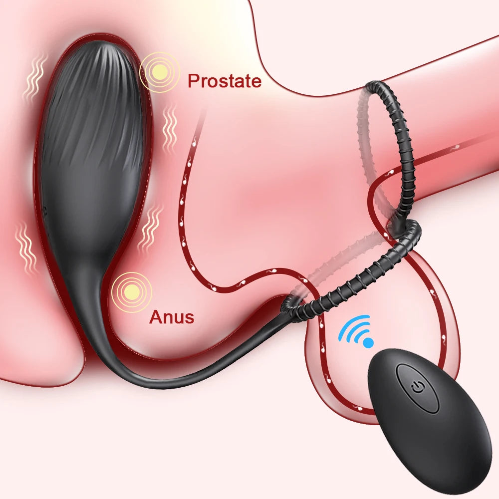 Remote-Control Prostate Massager with Ring